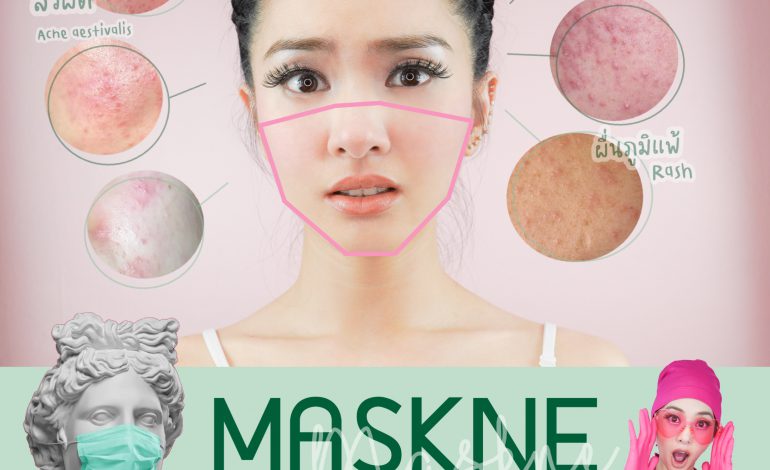  MASKNE ภาวะผิวระคายเคืองที่เกิดจากการใส่หน้ากากอนามัย | Dr. Dream Clinic คลินิกหมอดรีม